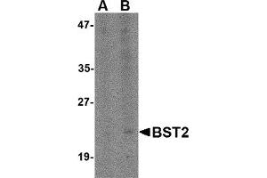 Western Blotting (WB) image for anti-Bone Marrow Stromal Cell Antigen 2 (BST2) (N-Term) antibody (ABIN1031283) (BST2 antibody  (N-Term))