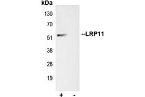 Immunoprecipitation of LRP11 from 0. (LRP11 antibody  (Center))