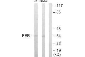 Western blot analysis of extracts from JK and HUVEC cells, using FER antibody. (FER antibody  (C-Term))