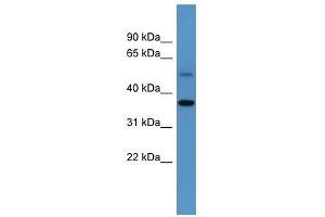 Gyg antibody used at 0. (GYG antibody  (C-Term))