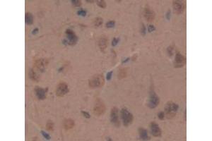 Figure. (NPPC antibody  (AA 31-126))