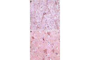 Immunohistochemical analysis of paraffin-embedded human cerebrum (A) and myelencephalon (B) tissue, showing cytoplasmical localization, using DNM2 monoclonal antibody, clone 5E4C2F3  with DAB staining. (DNM2 antibody)