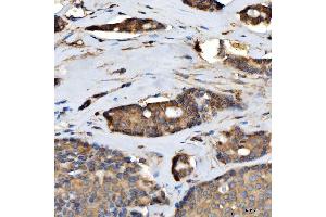 IHC analysis of TTLL2 using anti-TTLL2 antibody (ABIN7600850). (TTLL2 antibody  (AA 24-582))