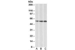 Western blot testing of A) HeLa, B) HepG2 and C) K562 cell lysate using HMGCS1 antibody at 1ug/ml. (HMGCS1 antibody)