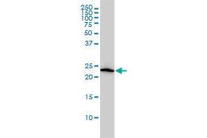 VBP1 monoclonal antibody (M01), clone 3D11 Western Blot analysis of VBP1 expression in HL-60 . (VBP1 antibody  (AA 1-197))