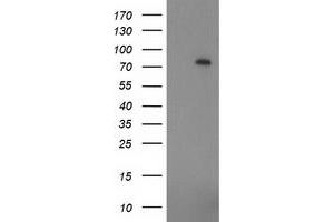 Western Blotting (WB) image for anti-Zinc Finger, Imprinted 2 (ZIM2) (AA 1-150), (AA 428-527) antibody (ABIN1490589) (ZIM2 antibody  (AA 1-150, AA 428-527))