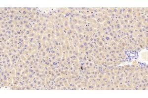Detection of PCK1 in Mouse Liver Tissue using Polyclonal Antibody to Phosphoenolpyruvate Carboxykinase 1, Soluble (PCK1) (PCK1 antibody  (AA 312-563))