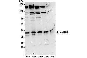 Western Blotting (WB) image for anti-Zinc Finger CCHC-Type and RNA Binding Motif 1 (ZCRB1) (AA 155-205) antibody (ABIN7450929)