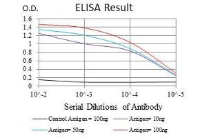 Black line: Control Antigen (100 ng), Purple line: Antigen(10 ng), Blue line: Antigen (50 ng), Red line: Antigen (100 ng), (MSH6 antibody)