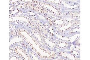 ABIN6267315 at 1/200 staining human kidney tissue sections by IHC-P. (Retinoblastoma 1 antibody  (pSer780))