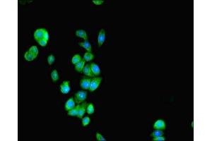 Immunofluorescent analysis of PC-3 cells using ABIN7162107 at dilution of 1:100 and Alexa Fluor 488-congugated AffiniPure Goat Anti-Rabbit IgG(H+L) (SEPSECS antibody  (AA 5-451))