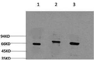 Western Blot analysis of 1) 293T, 2) C2C12, 3) Rat brain using BECN1 Monoclonal Antibody at dilution of 1:2000. (Beclin 1 antibody)