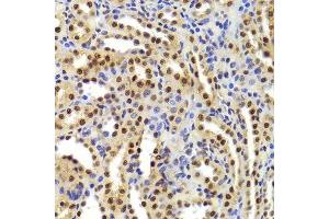 Immunohistochemistry (Paraffin-embedded Sections) (IHC (p)) image for anti-Acidic (Leucine-Rich) Nuclear phosphoprotein 32 Family, Member A (ANP32A) (AA 1-170) antibody (ABIN6136909)