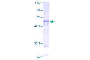 BBS9 Protein (AA 1-310) (GST tag)