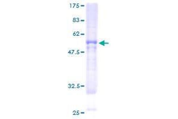 BBS9 Protein (AA 1-310) (GST tag)