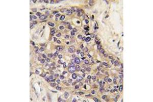 Image no. 2 for anti-Hepatocyte Growth Factor (Hepapoietin A, Scatter Factor) (HGF) (C-Term) antibody (ABIN357192) (HGF antibody  (C-Term))