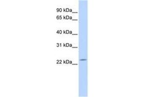 Image no. 1 for anti-Deleted in Primary Ciliary Dyskinesia Homolog (DPCD) (AA 36-85) antibody (ABIN6743816) (DPCD antibody  (AA 36-85))