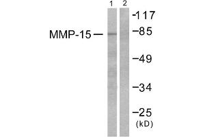 Western blot analysis of extracts from MDA-MB-435 cells, using MMP-15 antibody (ABIN5976459). (MMP15 antibody  (C-Term))