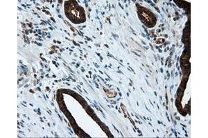 Immunohistochemical staining of paraffin-embedded liver tissue using anti-MTRF1L mouse monoclonal antibody. (MTRF1L antibody)