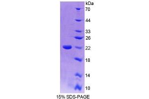 SDS-PAGE (SDS) image for Transcriptional Regulating Factor 1 (TRERF1) (AA 785-942) protein (His tag) (ABIN6239134) (TRERF1 Protein (AA 785-942) (His tag))