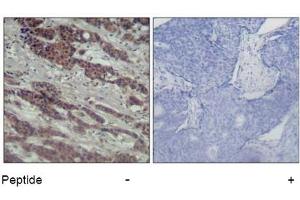 Image no. 2 for anti-V-Raf-1 Murine Leukemia Viral Oncogene Homolog 1 (RAF1) (Ser338) antibody (ABIN319326) (RAF1 antibody  (Ser338))