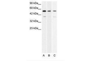 Image no. 1 for anti-H2.0-Like Homeobox (HLX) (AA 257-306) antibody (ABIN202646) (HLX antibody  (AA 257-306))
