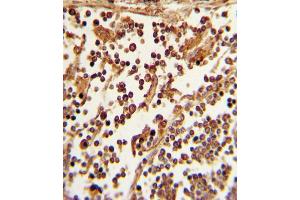 Formalin-fixed and paraffin-embedded human lymph tissue with SELL Antibody (C-term), which was peroxidase-conjugated to the secondary antibody, followed by DAB staining. (L-Selectin antibody  (C-Term))