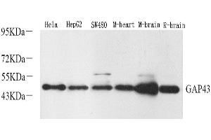 Western Blot analysis of various samples using GAP43 Polyclonal Antibody at dilution of 1:2000. (GAP43 antibody)