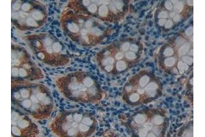 Detection of MMP12 in Human Rectum Tissue using Polyclonal Antibody to Matrix Metalloproteinase 12 (MMP12) (MMP12 antibody  (AA 290-469))