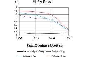 Black line: Control Antigen (100 ng),Purple line: Antigen (10 ng), Blue line: Antigen (50 ng), Red line:Antigen (100 ng) (Cytokeratin 13 antibody  (AA 104-458))