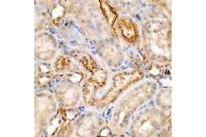 Immunohistochemistry of paraffin-embedded rat kidney using [KO Validated] Granulin Rabbit mAb  at dilution of 1:500 (40x lens). (Granulin antibody)