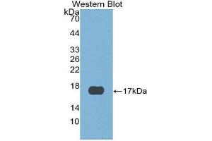 Western Blotting (WB) image for anti-Cystatin E/M (CST6) (AA 29-149) antibody (ABIN1867420) (CST6 antibody  (AA 29-149))