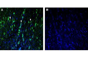 Expression of TMEM175 in rat medial septum. (TMEM175 antibody  (AA 278-291))