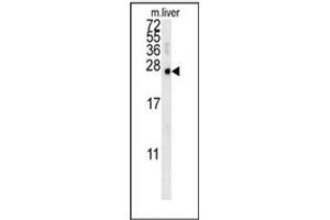 Western blot analysis of MCEE Antibody (C-term) in mouse liver tissue lysates (15ug/lane). (MCEE antibody  (C-Term))