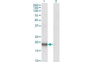 Western Blot analysis of ARPC3 expression in transfected 293T cell line by ARPC3 monoclonal antibody (M06), clone 2E11. (ARPC3 antibody  (AA 1-78))