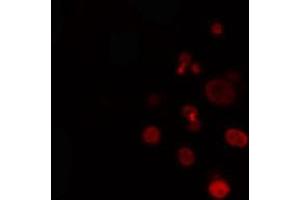 ABIN6274330 staining Hela cells by IF/ICC. (FOXL1 antibody  (Internal Region))