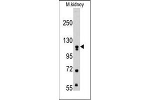 Image no. 1 for anti-Muscle, Skeletal, Receptor Tyrosine Kinase (MUSK) antibody (ABIN359904) (MUSK antibody)