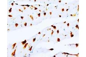 Immunohistochemistry (Paraffin-embedded Sections) (IHC (p)) image for anti-Deoxyuridine Triphosphatase (DUT) (Middle Region) antibody (ABIN1107021)
