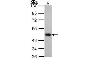 WB Image Sample (30 ug of whole cell lysate) A: A431 , 10% SDS PAGE antibody diluted at 1:1000 (Medium-Chain Specific Acyl-CoA Dehydrogenase, Mitochondrial (N-Term) antibody)