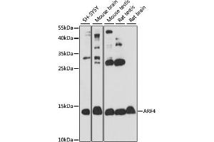 Western blot analysis of extracts of various cell lines, using  antibody (ABIN7265482) at 1:1000 dilution. (ARF4 antibody  (AA 1-180))