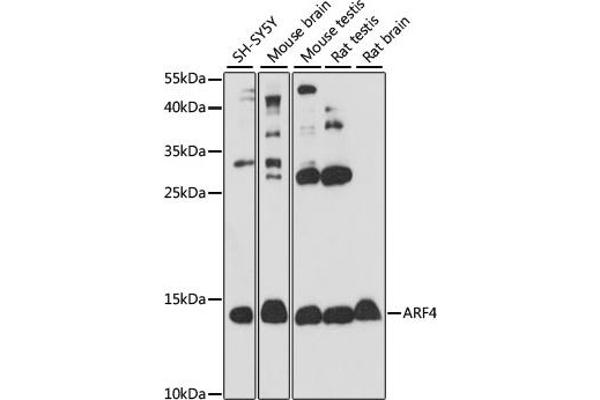 ARF4 Antikörper  (AA 1-180)