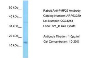 Image no. 1 for anti-Peripheral Myelin Protein 22 (PMP22) (AA 27-76) antibody (ABIN6749963) (PMP22 antibody  (AA 27-76))