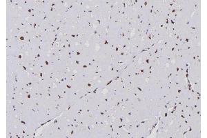ABIN6276683 at 1/100 staining Human heart tissue by IHC-P.