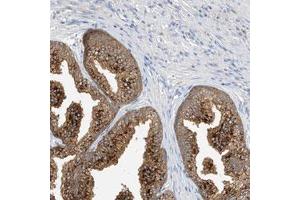 Immunohistochemical staining (Formalin-fixed paraffin-embedded sections) of human prostate with C3orf39 polyclonal antibody  shows strong cytoplasmic positivity in glandular cells.