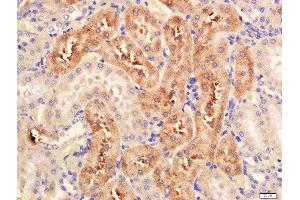 Formalin-fixed and paraffin embedded rat kidney labeled with Anti-Serine Racemase Polyclonal Antibody, Unconjugated  at 1:200 followed by conjugation to the secondary antibody and DAB staining. (SRR antibody  (AA 1-100))