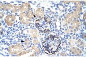 Immunohistochemical staining (Formalin-fixed paraffin-embedded sections) of human kidney with CLIC5 polyclonal antibody  at 4-8 ug/mL working concentration.