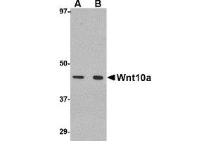 Western Blotting (WB) image for anti-Wingless-Type MMTV Integration Site Family, Member 10A (WNT10A) (C-Term) antibody (ABIN1030803)