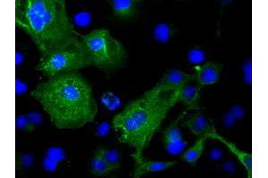Image no. 2 for anti-Cardiac Troponin I (TNNI3) antibody (ABIN1497101) (TNNI3 antibody)
