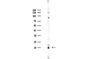 Western blot analysis of lysates from K562 cells(heat-shock 45 min treatment), using Acetyl-Histone H2A.