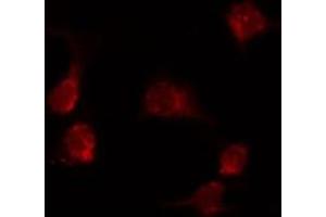 ABIN6274020 staining MCF7 by IF/ICC. (KDELR1 antibody  (Internal Region))